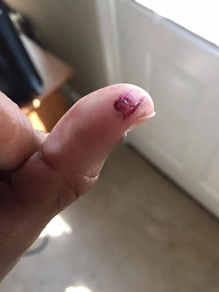 cut-thumb